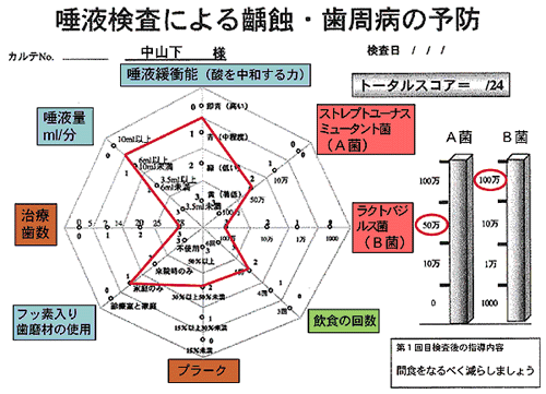 カリエスリスク検査について