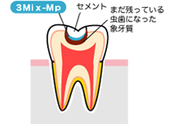 3Mix-Mp�@