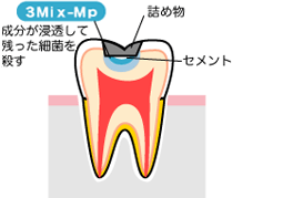 3Mix-Mp�@